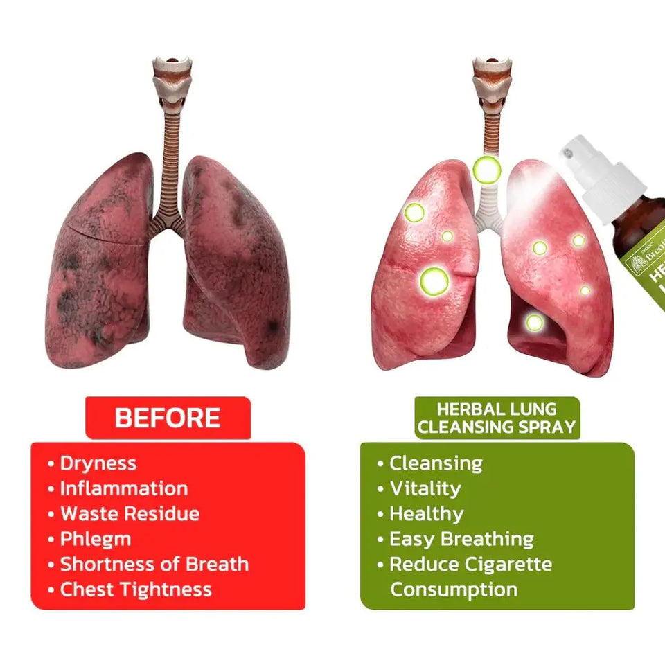 Afinmex™ BreathDetox Herbal Lung Cleansing Spray