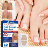 Afinmex™ Ingrown Toenail Corrector Patches