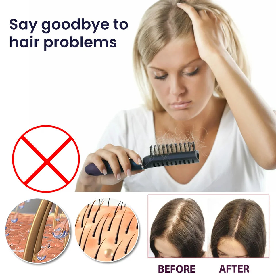 Afinmex™ Natural Hair Regrowth Spray