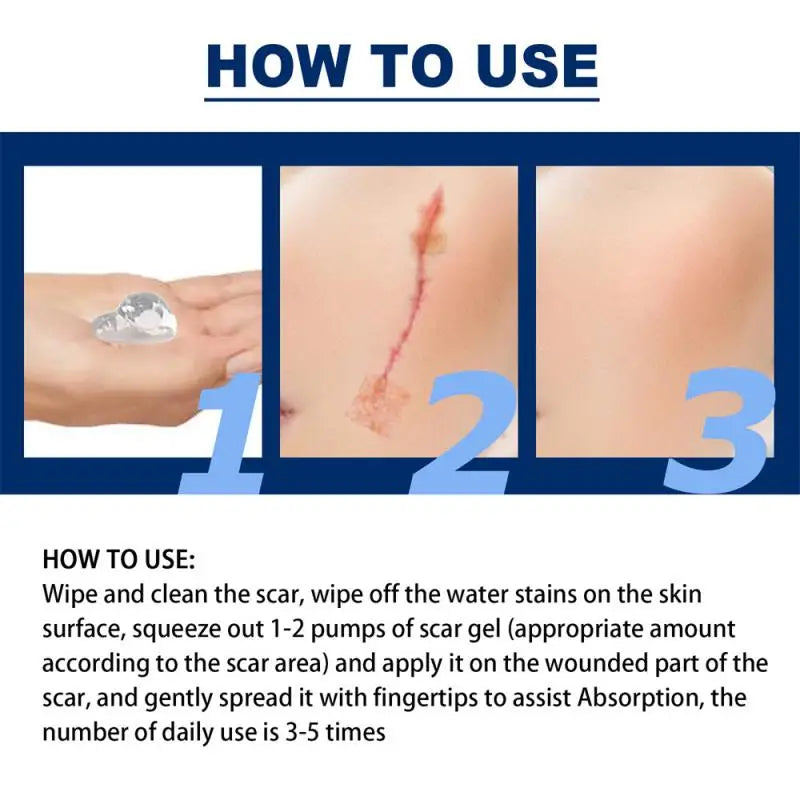 Afinmex™ Advanced Scar Spray For All Types of Scars