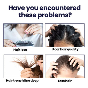 Afinmex™ Natural Hair Regrowth Spray