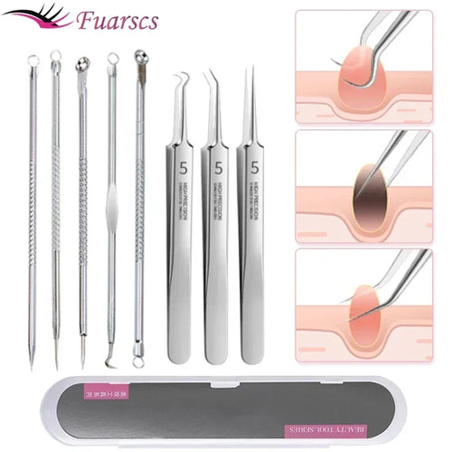 Afinmex™ Blackhead Remover Acne  Tool