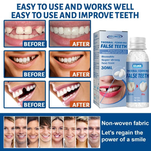 Afinmex™ Resin Dentures Temporary Repair Teeth