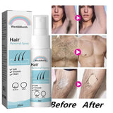 Afinmex™  Hair Removal Spray Foam